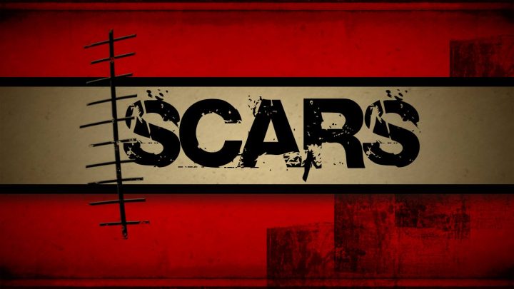 scars-art-mtn1